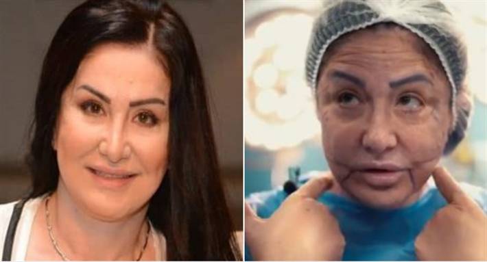 بعد ظهورها بوجه مشوّه بسبب التجميل... هذا ما كشفته وفاء سالم عن حالتها