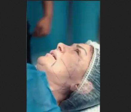 بالفيديو - نجمة مصرية تعترف بتشوه وجهها بسبب التجميل وتتعرض للابتزاز