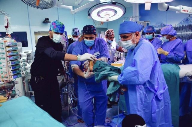 بالفيديو -فريق طبّي سعودي يفصل التوأم السيامي 
