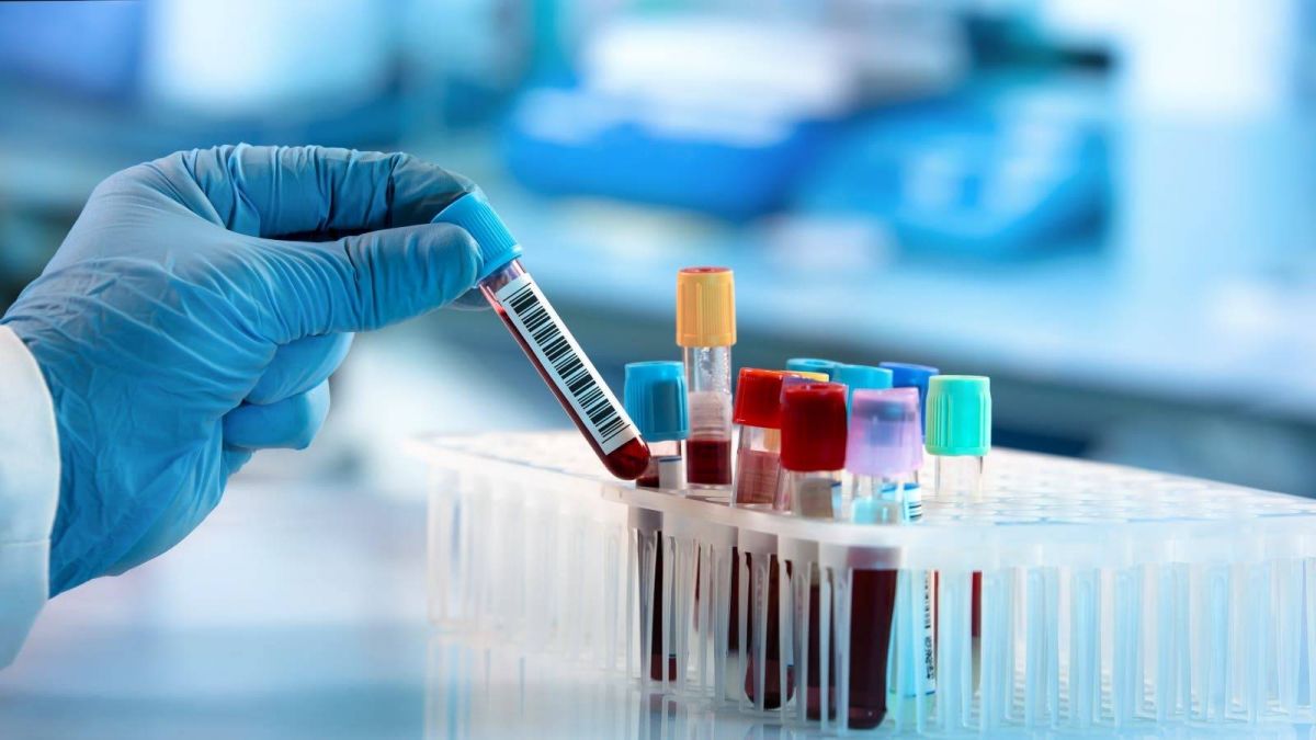 أداة جديدة لرصد السرطان عبر فحص الدم