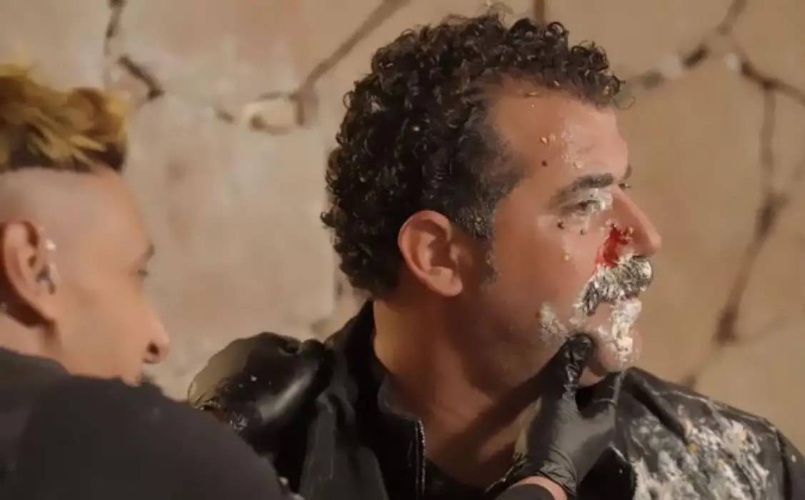 دماء وإصابة في الوجه في حلقة محمود حافظ مع رامز جلال