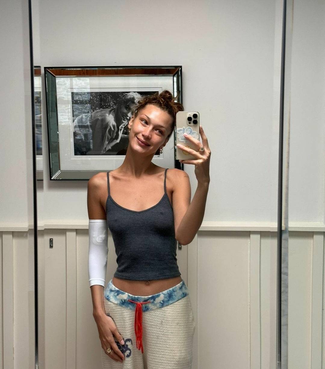 بالصور - بيلا حديد توثّق معاناتها وتشارك رحلتها الصعبة مع المرض