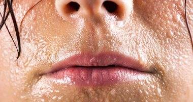 تعرّق الوجه... خطوات بسيطة لحلّ هذه المشكلة