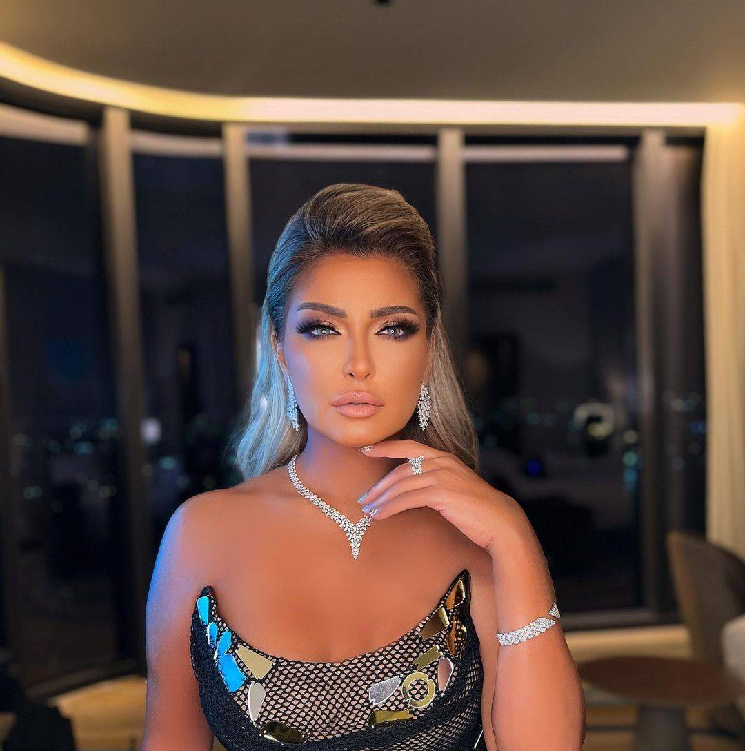 انتفاخ وجه علا غانم وتغيّر شكلها حديث الجمهور... تجميل أم فيلتر؟