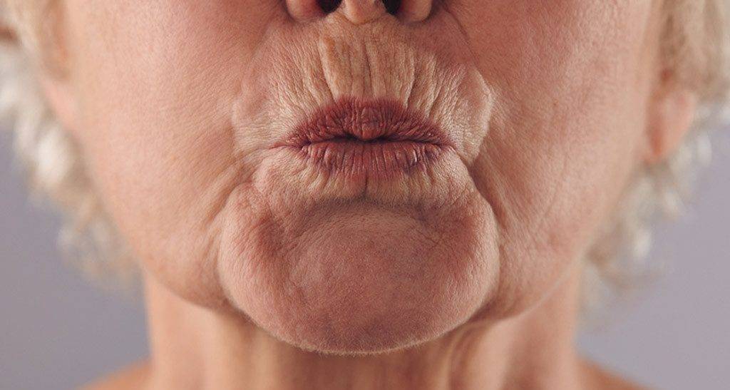 نصائح بسيطة للتخلص من التجاعيد حول الفم