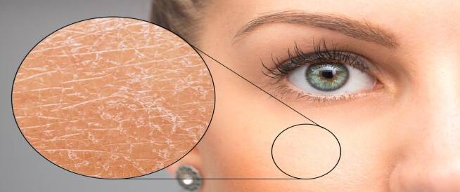 خطوات ضرورية لحماية البشرة وعلاجها من الجفاف