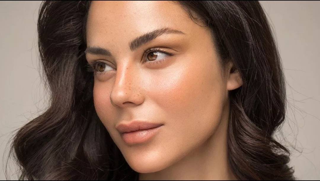 النمش... كل ما عليكِ معرفته عن طرق التخلّص منه