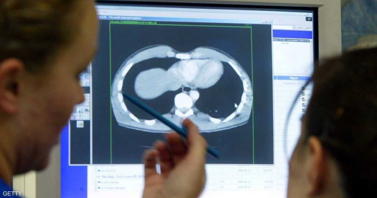 دق ناقوس خطر بسبب إنتشار آكلة الدماغ