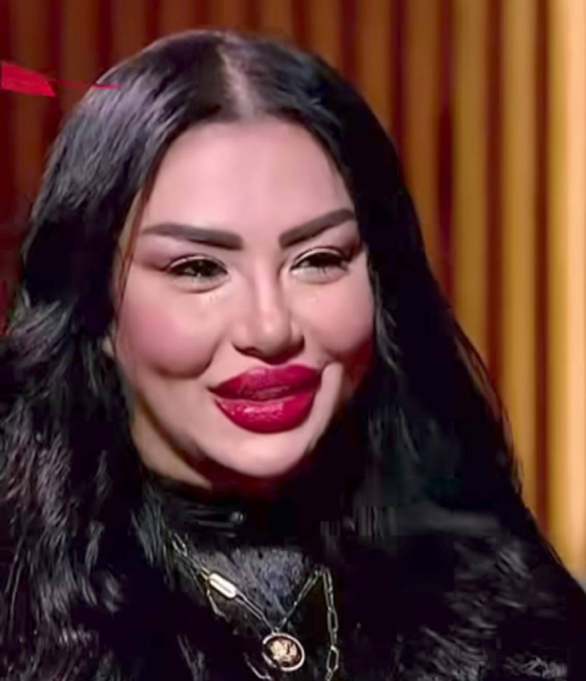 إيمان أيوب بعد التجميل
