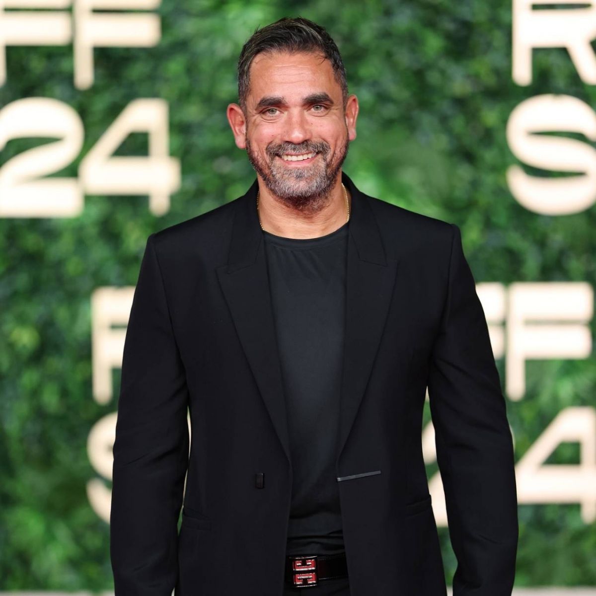 أمير كرارة يُحدث ضجة بصورة لسيارة محطمة