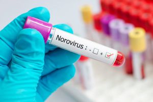 تحذير من انتشار الـNoroVirus وطُرق الوقاية منه