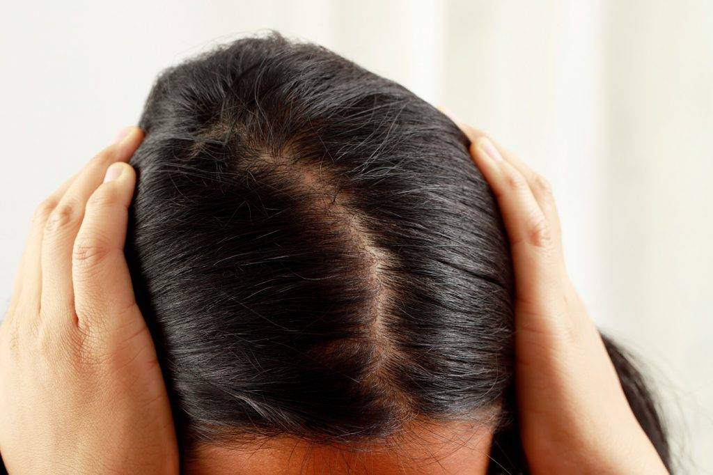 عصير بسيط يعالج الفراغات وبقع الصلع المزعجة