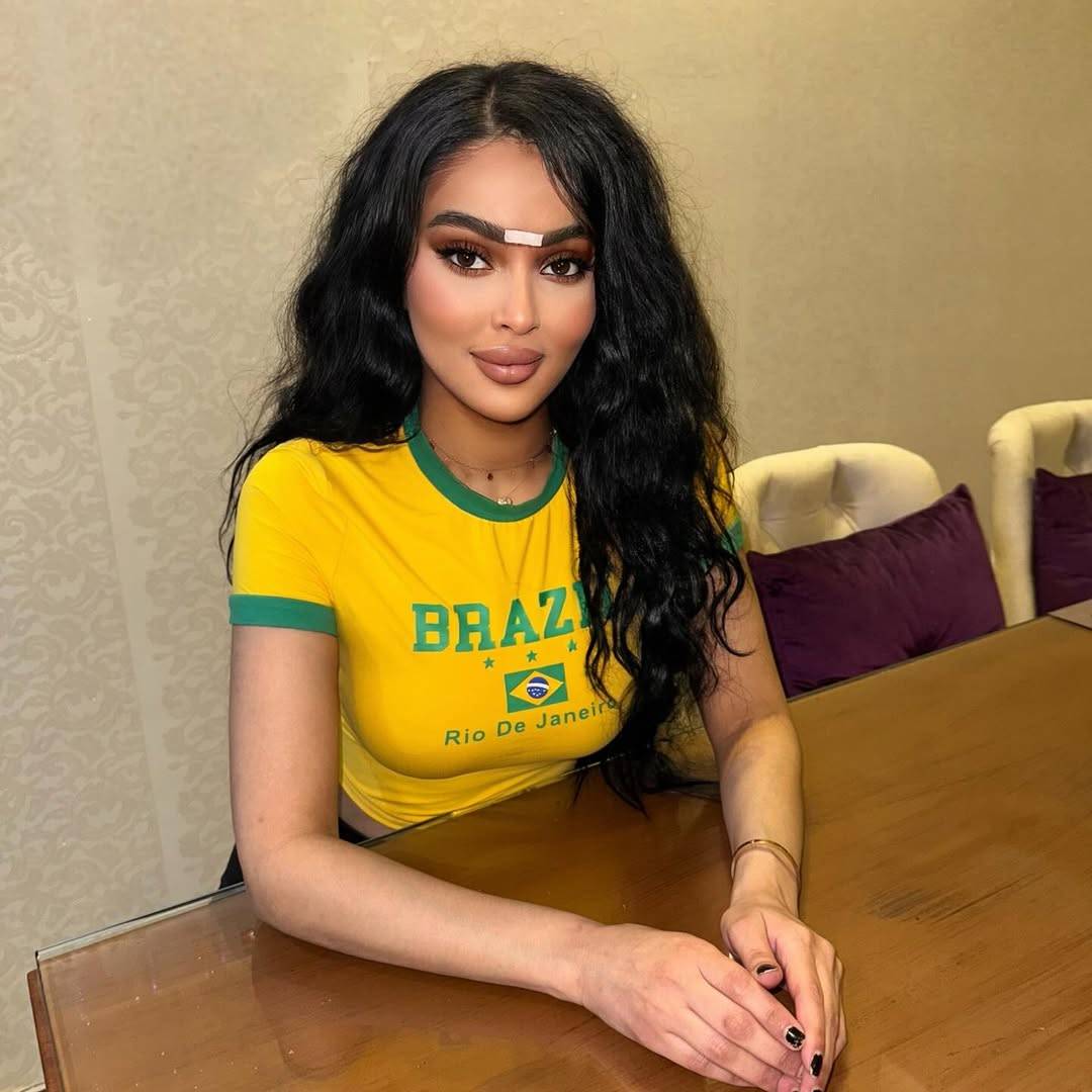 بعد تشوه وجهها.. هذا ما فعلته رومي القحطاني