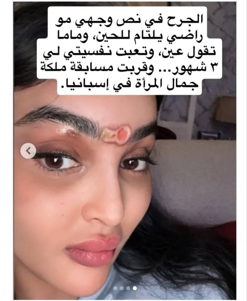 منشور رومي القحطاني عن الإصابة الأولى