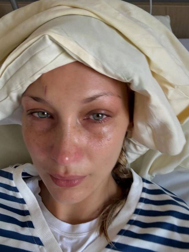 بيلا حديد مريضة ومُتعبة