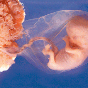 إختيار جنس الجنين