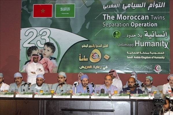 فصل التوأمين السياميتين عزيزة وسعيدة