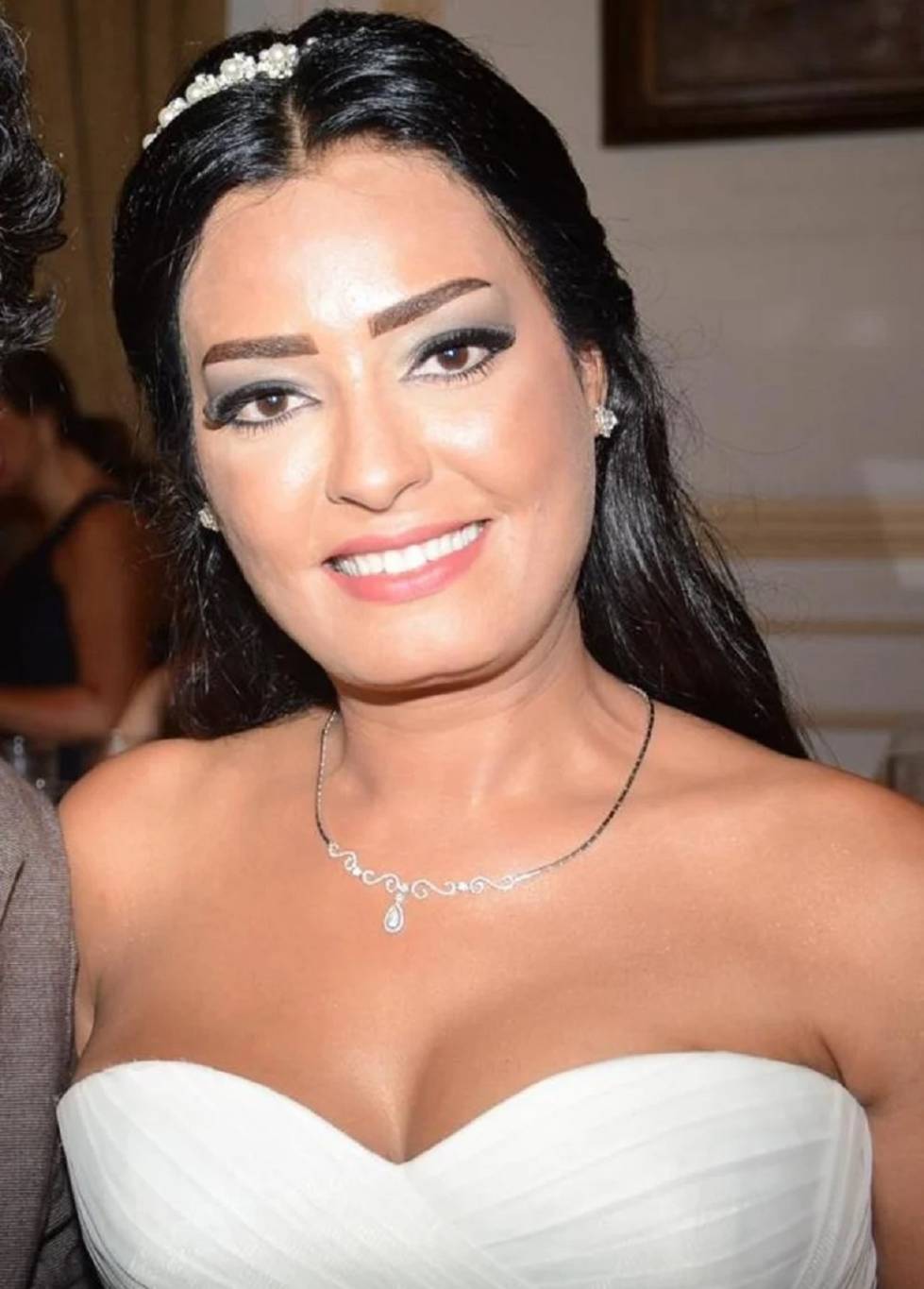 ملكة جمال مصر تحكي عن معاناتها اليومية مع ورم في المخ