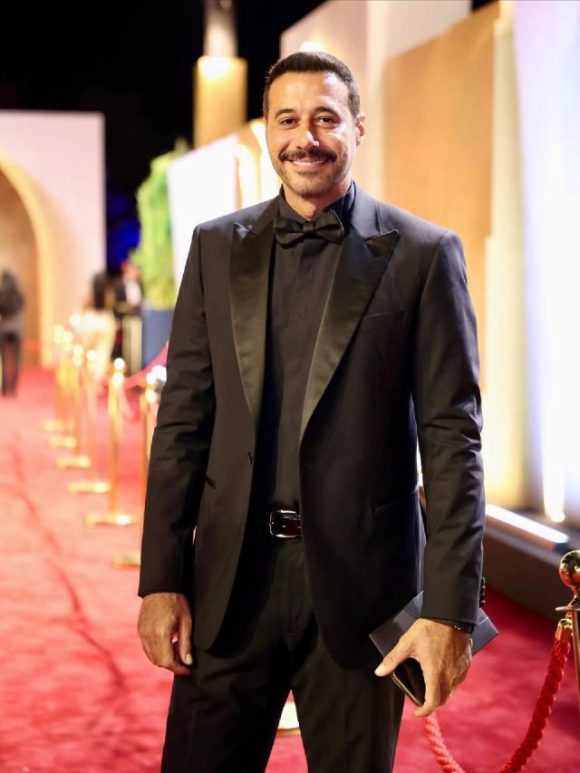 أحمد السعدني يوضح أسباب ظهوره في الجونة وقد تعرّض لإصابة بيده