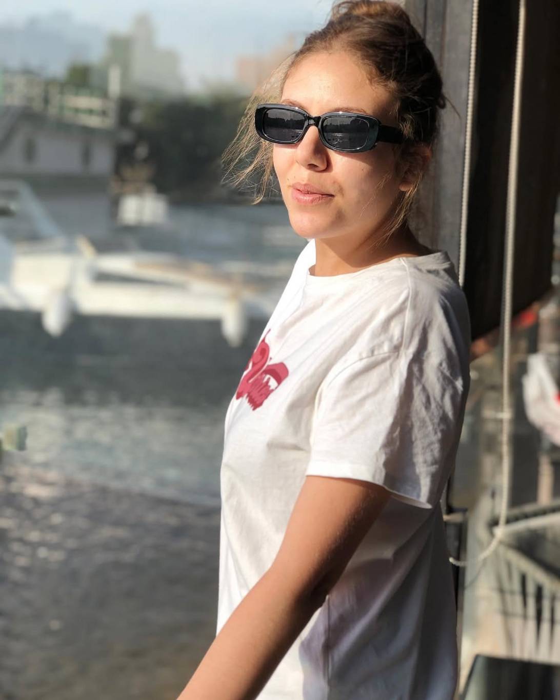 رحمة حسن تعلن إصابتها بعاهة مستديمة بسبب خطأ طبي