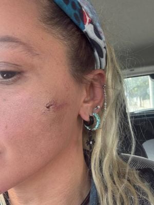 قضية رأي عام... نجمة تركية تُعنَّف من زوجها