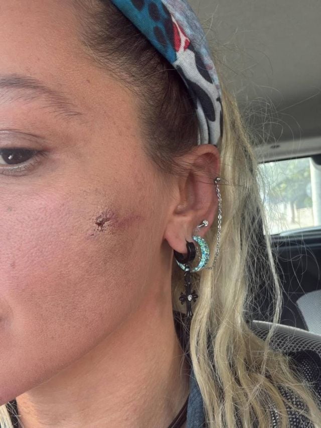 النجمة التركية تتعرّض للضرب