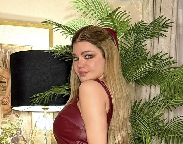 ياسمين الخطيب تعلن عن خضوعها لجراحة بالوجه بعد إصابتها بعدوى بكتيرية