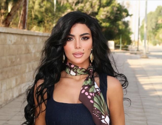 كارولين عزمي تطمئن محبيها عليها بعد إصابتها في برنامج رامز جلال