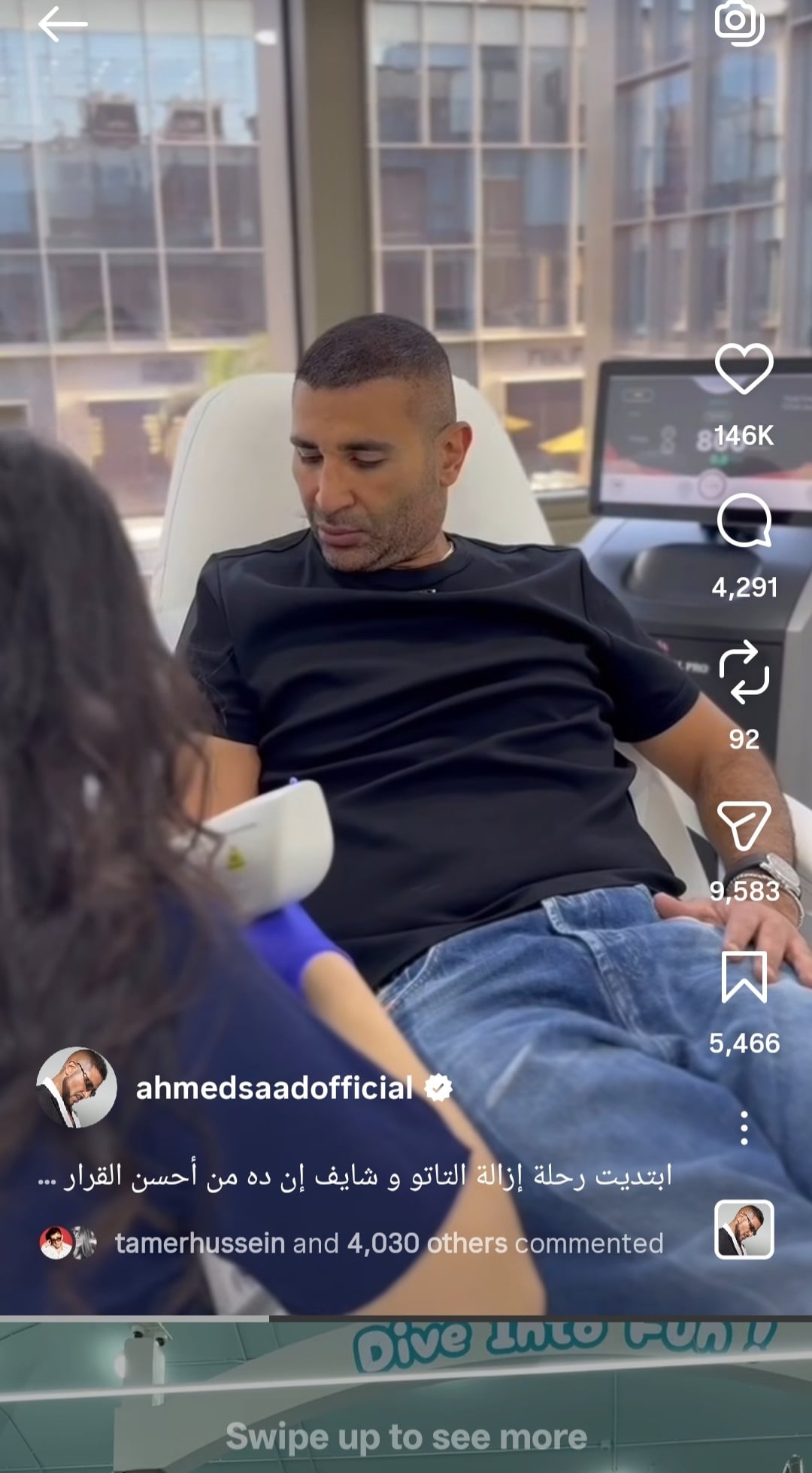 احمد سعد خلال إزالة الوشم