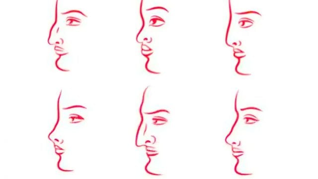 أشكال الأنف