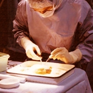 هل يجوز تبرُّع المسلمين بأعضائهم لغير المسلمين؟