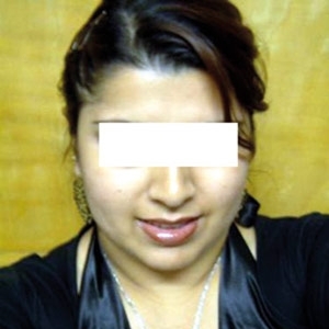 تحرش بها فشوّهته بماء النار!