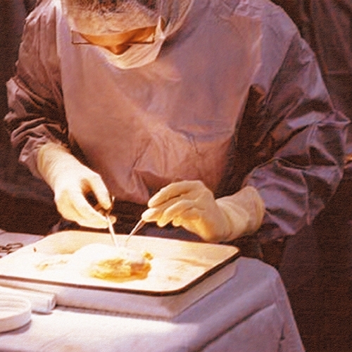 هل يجوز تبرُّع المسلمين بأعضائهم لغير المسلمين؟