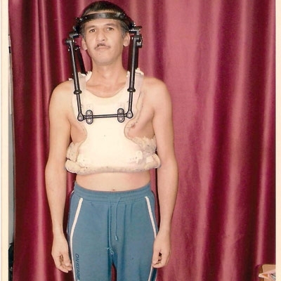 جهاد السعيد الناجي السوري الوحيد من تحطّم طائرة يروي تفاصيل الحادث...