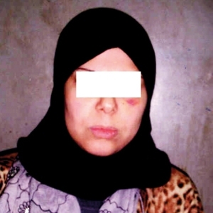 شوّهت وجه زوجة طليقها...