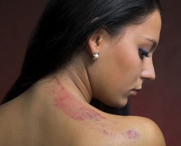 <strong  dir='ltr'>50 </strong>ألف ريال عقوبة من يضرب زوجته في السعودية