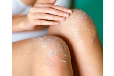 حلّ سحري لاسمرار الجلد عند ركبة القدمين وكوع الساعدين!