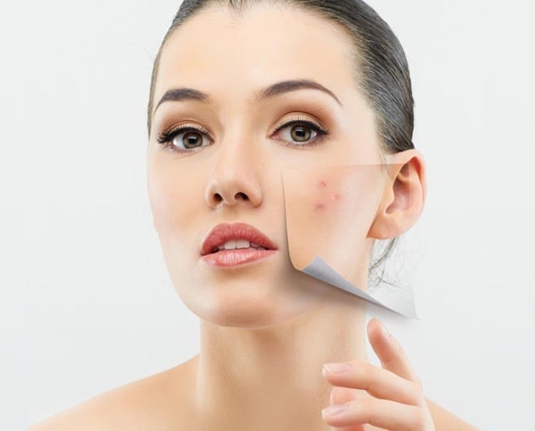 نصائح بسيطة لمعالجة حبّ الشباب