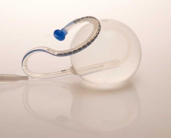 بالون في المعدة