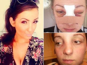 بالصور- عنّفها حبيبها فتحوّلت إلى ملكة جمال