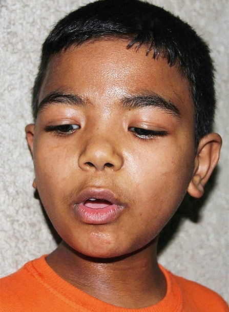 أحد الأطفال الذين تعرضوا للاعتداء