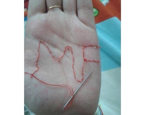 معجبة مهووسة تخيط اسم ميريام فارس على يدها