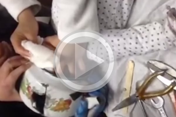 بالفيديو- طفل أدخل رأسه في إبريق شاي! شاهدوا ماذا حلّ به