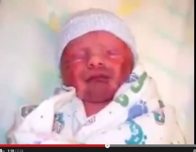 فيديو مهم - لا تهزّوا أطفالكم قد تتسببون في عاهة مستديمة لهم!