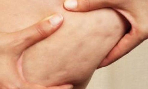 لديك طماطم وجيلاتين وليمون وأناناس في البراد؟ أبشري فلقد تخلّصت من السيلوليت!