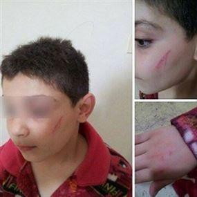 بالصور-  ضربته المعلمة أم تعارك مع زميله!