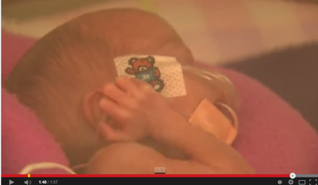 بالفيديو- ولادة أصغر طفلة في العالم بحجم هاتف خلوي، هل ستعيش؟