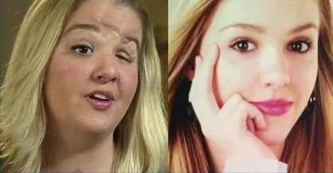 بالفيديو - كانت عارضة أزياء جميلة وتحوّلت إلى... ما الذي شوّهها هكذا؟