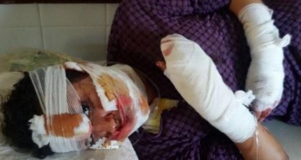 عربية، اغتصبها ثم تزوجها وحين طلبت الطلاق مزّق جسدها!