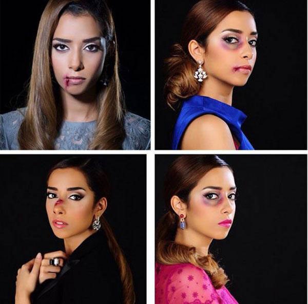 بعد نشر صورها 